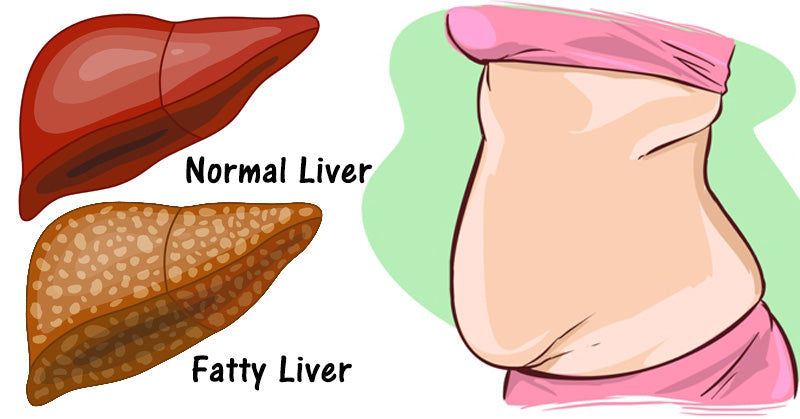 liver toxins FI