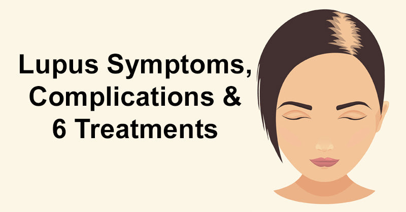 Lupus Symptoms, Complications & 6 Treatments