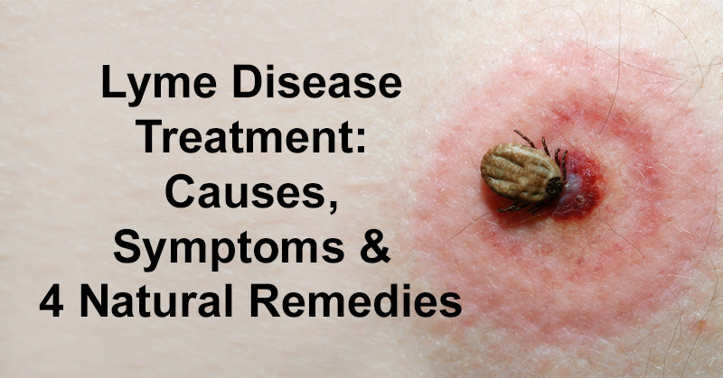 Lyme Disease Treatment: Causes, Symptoms & 4 Natural Remedies