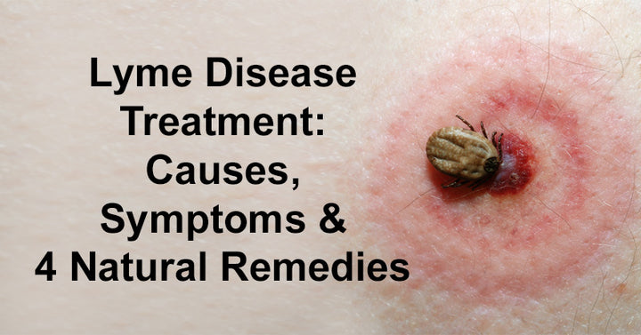 Lyme Disease Treatment: Causes, Symptoms & 4 Natural Remedies