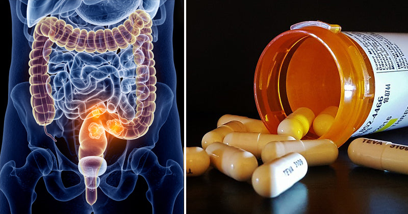 medication colon cancer FI