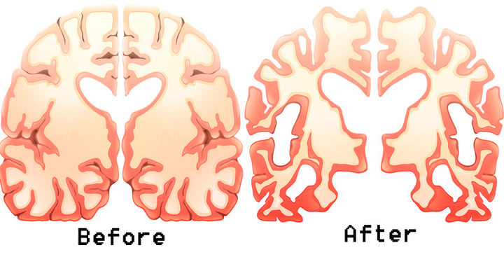 milk brain damage FI