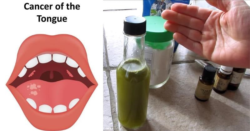 mouthwash FI
