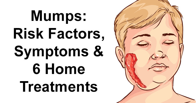 Mumps: Risk Factors, Symptoms & 6 Home Treatments