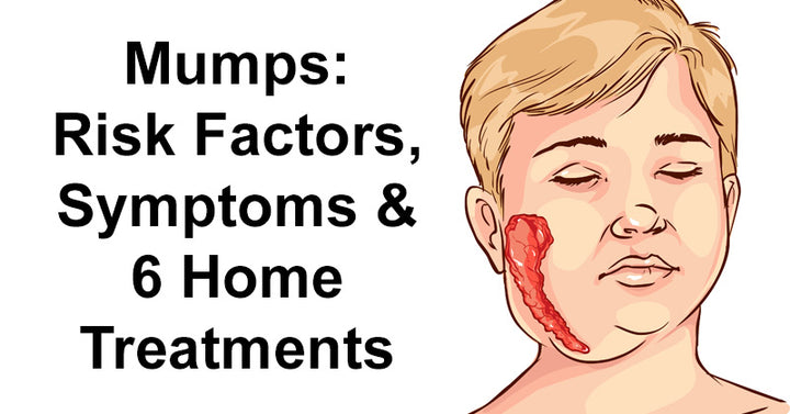 Mumps: Risk Factors, Symptoms & 6 Home Treatments