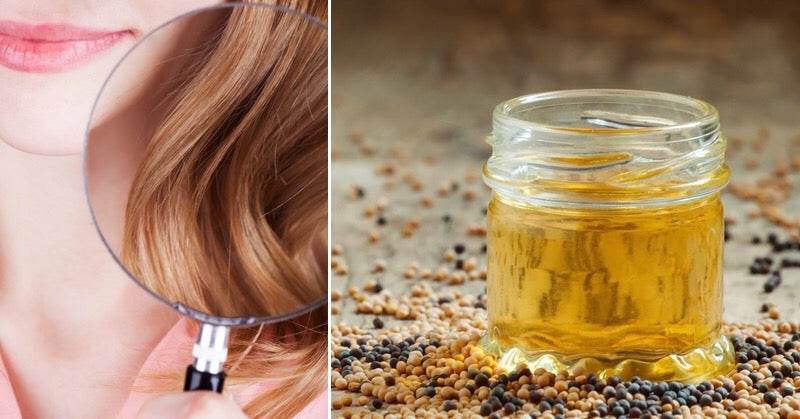 Is Mustard Oil Safe? Benefits & Side Effects To Watch Out For