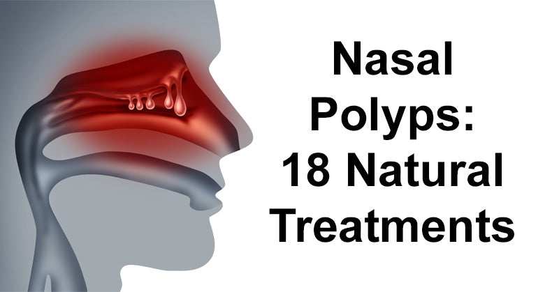 Nasal Polyps: 18 Natural Treatments