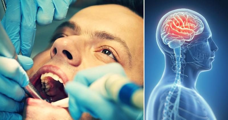 neurotoxin teeth FI