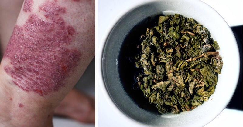 oolong tea benefits