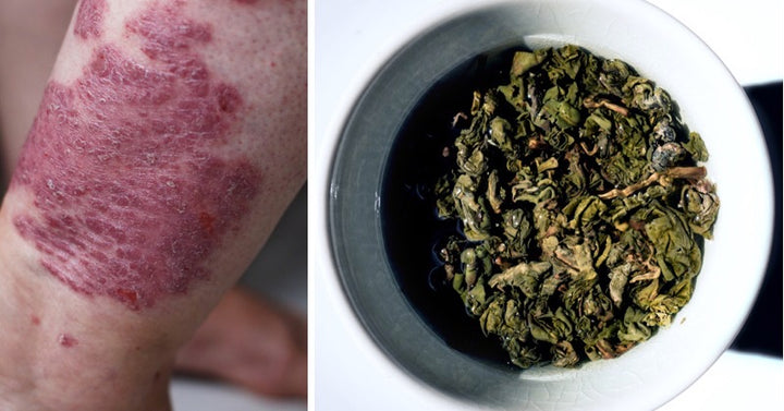 oolong tea benefits