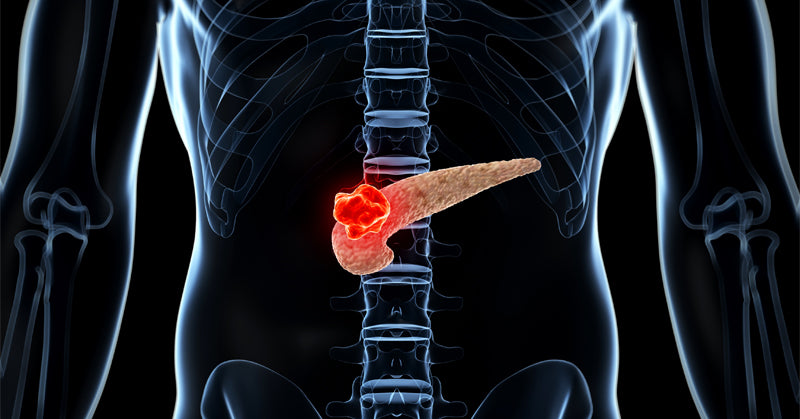pancreatic cancer turmeric FI
