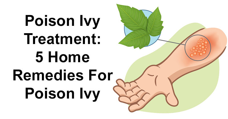 Poison Ivy Treatment: 5 Home Remedies For Poison Ivy