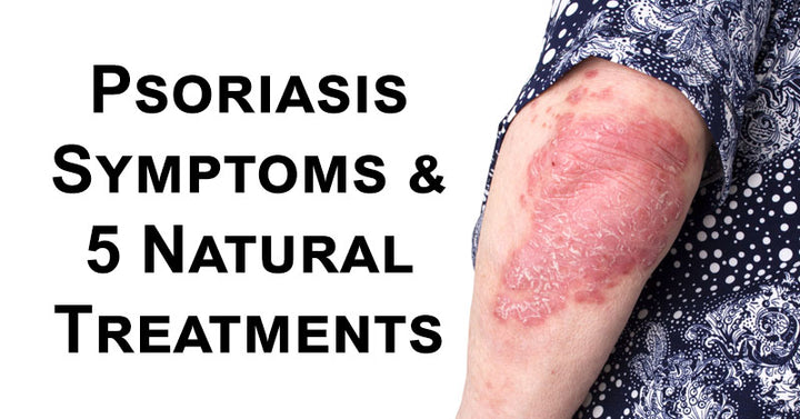 psoriasis symptoms FI