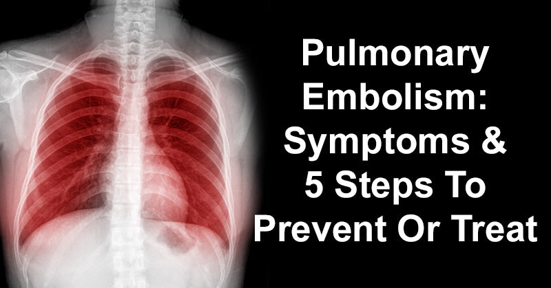 Pulmonary Embolism: Symptoms & 5 Steps To Prevent Or Treat