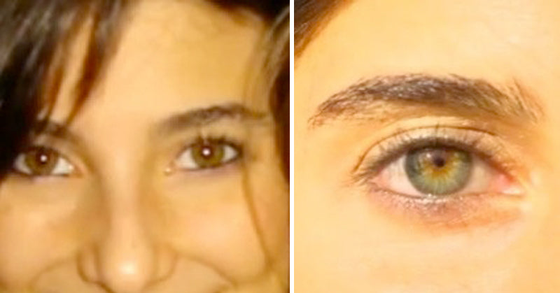 raw food diet eyes FI