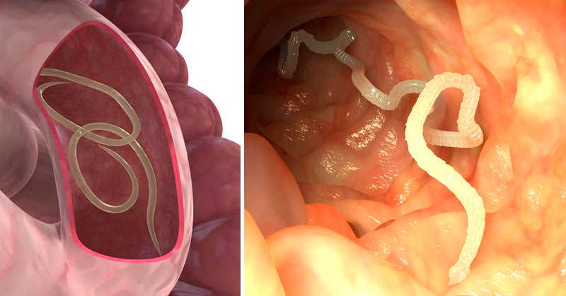 remove internal parasites FI