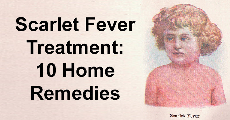 Scarlet Fever Treatment: 10 Home Remedies