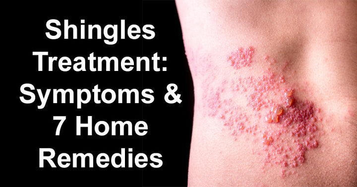 Shingles Treatment: Symptoms & 7 Home Remedies For Shingles
