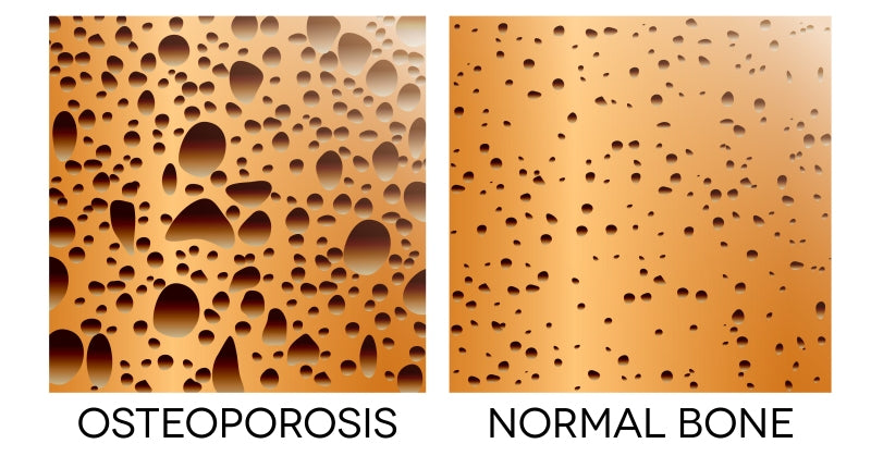 Pasteurized Milk Does Not Do A Body Good! This Is Why!