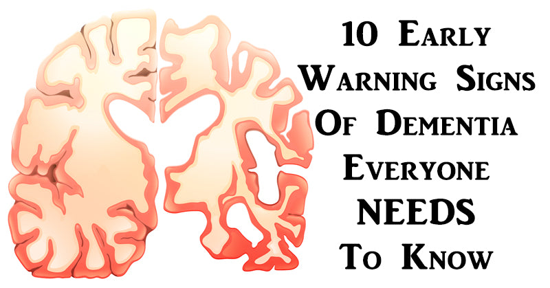 signs dementia FI