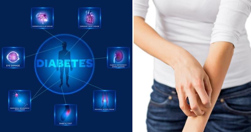 signs diabetes FI