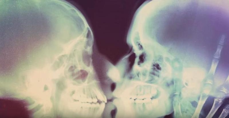 skeletons resized