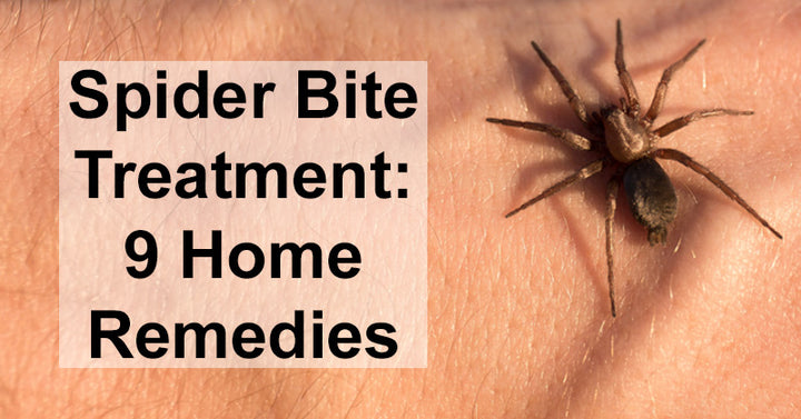 Spider Bite Treatment: 9 Home Remedies