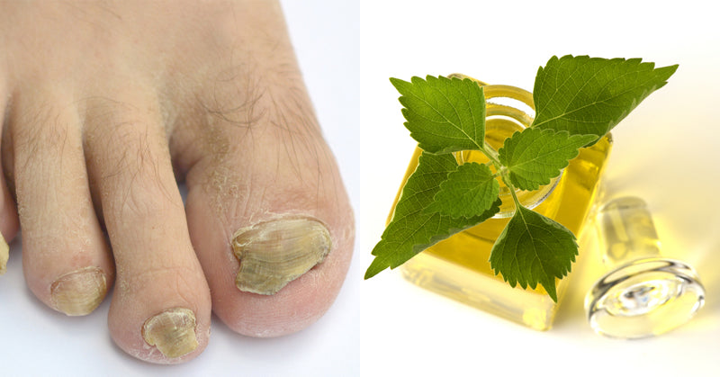 spikenard essential oil FI