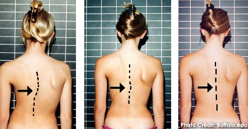 spine-curve-issues