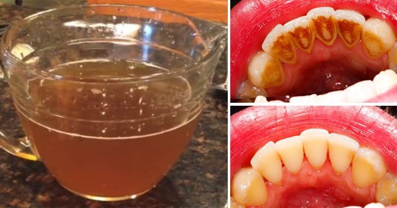 green tea mouthwash FI