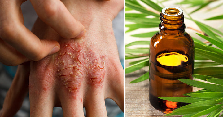 tea tree essential oil FI