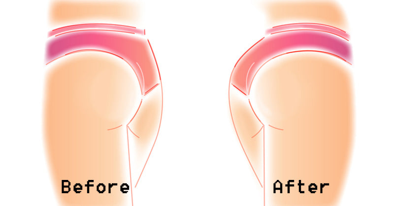 tight butt FI