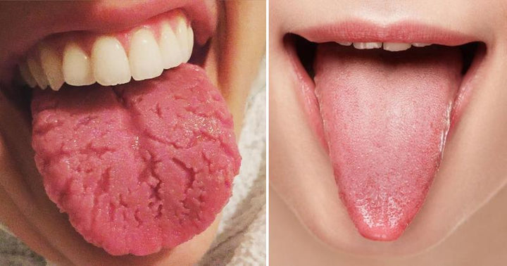 tongue health FI