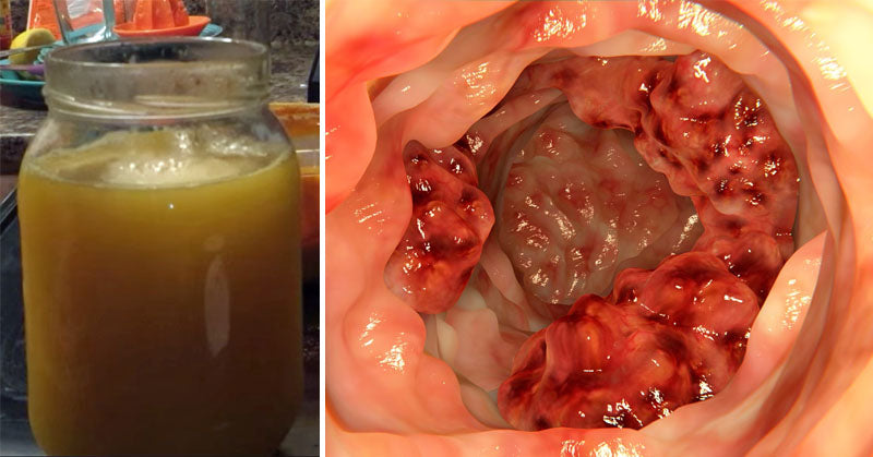 turmeric cancer drink FI