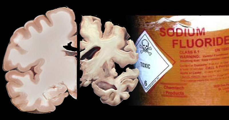 turmeric fluoride FI