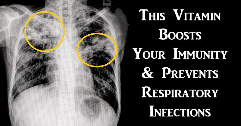 vitamin infections FI