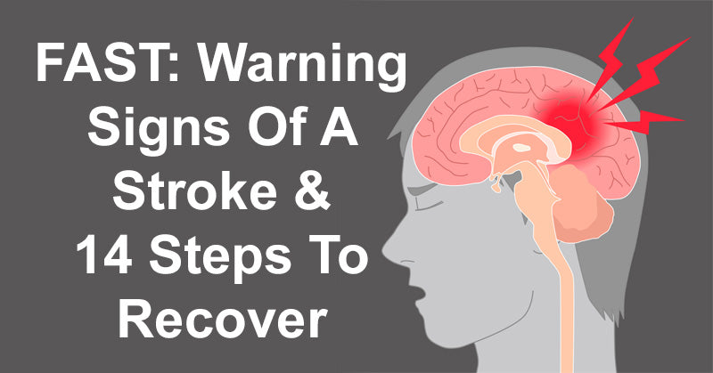 FAST: Warning Signs Of A Stroke & 14 Steps To Recover
