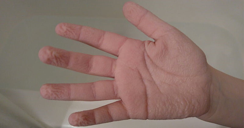 wrinkle hands FI