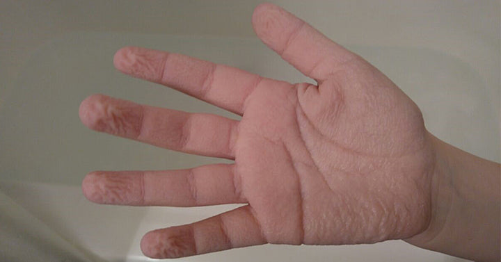 wrinkle hands FI