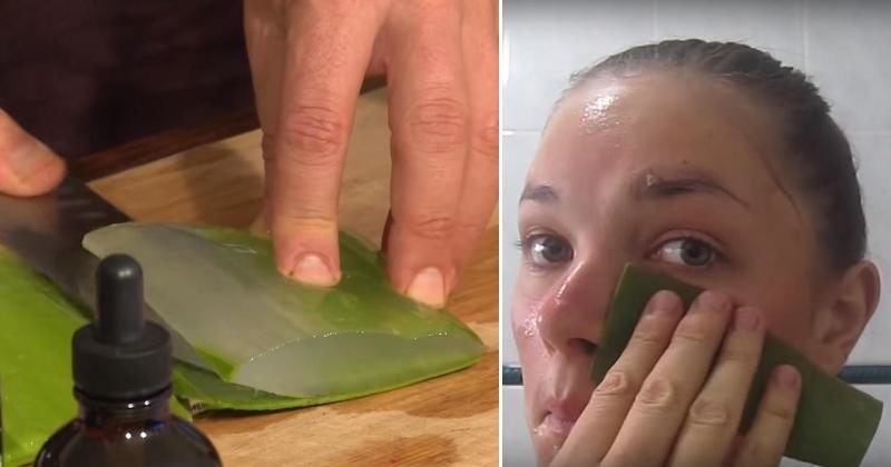 She Rubs Aloe Vera on Her Face for 7 Days, and the Results ...